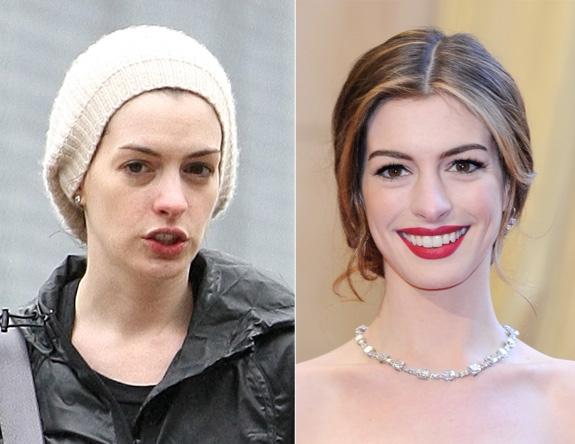 anne-hathaway_575_444 30 Celebrities Without Makeup - Part 1