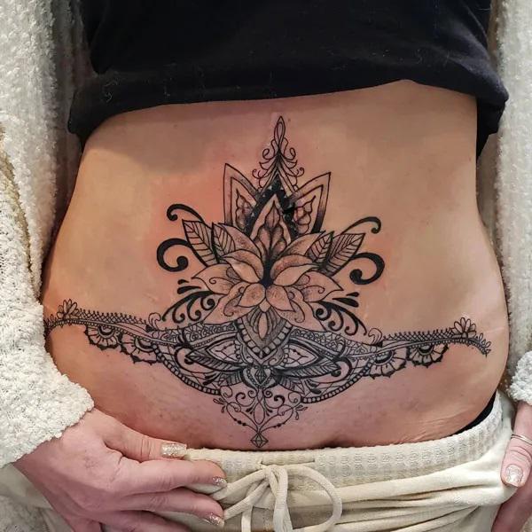 Tummy Tuck Tattoo: What You Need to Know