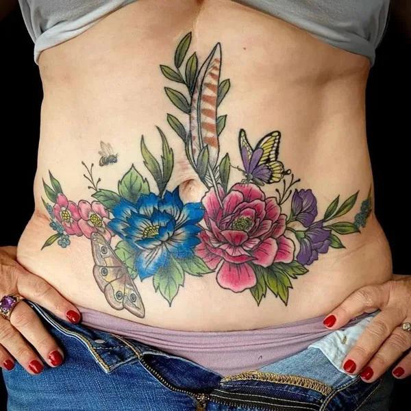 Tummy Tuck Tattoo: What You Need to Know