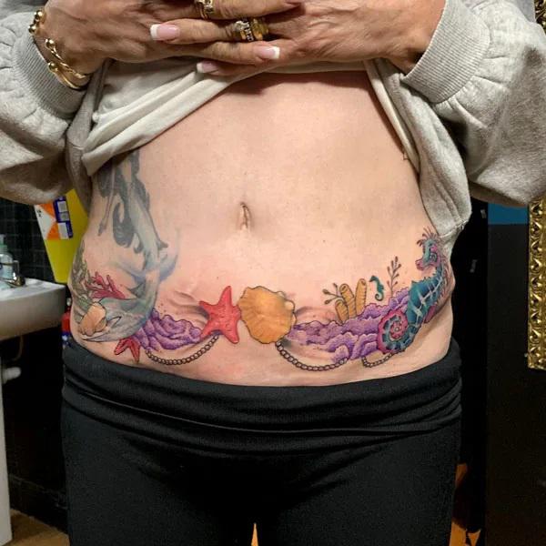 Tummy Tuck Tattoo: What You Need to Know