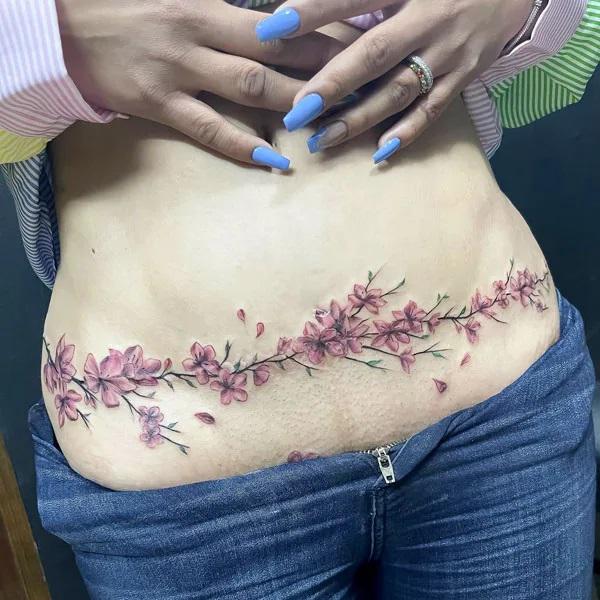 Tummy Tuck Tattoo: What You Need to Know