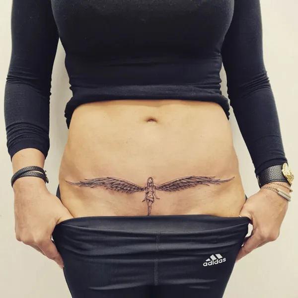 Tummy Tuck Tattoo: What You Need to Know