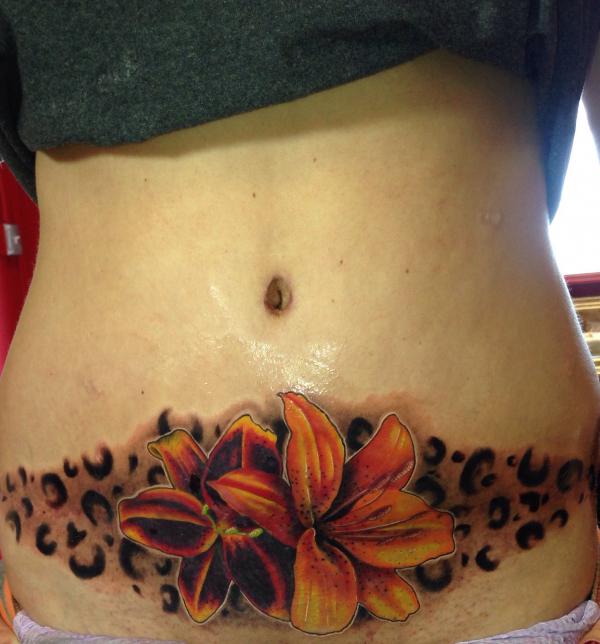 Tummy Tuck Tattoo: What You Need to Know